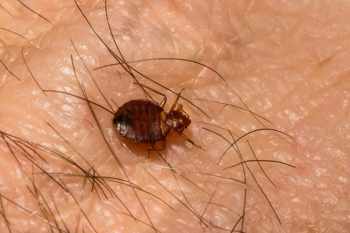 Bed Bug on human skin - less than 1mm in size, bed bugs are hard to identify by sight.
