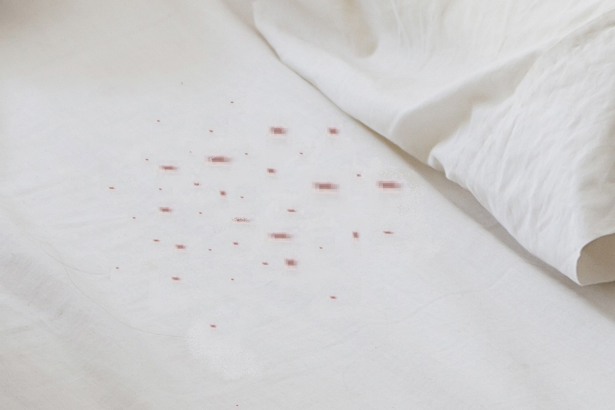 Blood stained sheets a sign of bed bug infestation